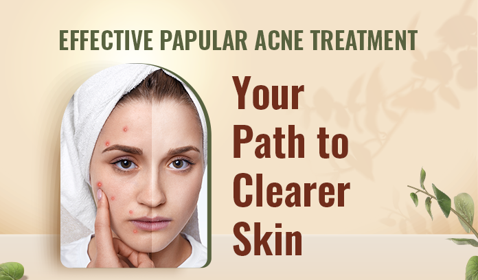 Clinmate Skin: Effective Acne Treatment Solutions