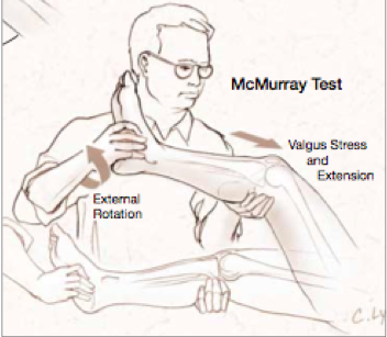 Knee Examination Right Knee Examination Maneuvers Include The Lachman