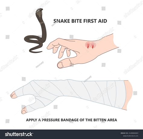 Snake Bite Treatment Stock Photos Royalty Free Snake Bite Treatment